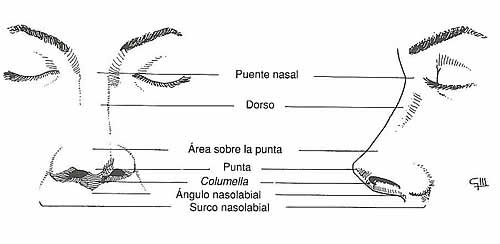 rinoplastia